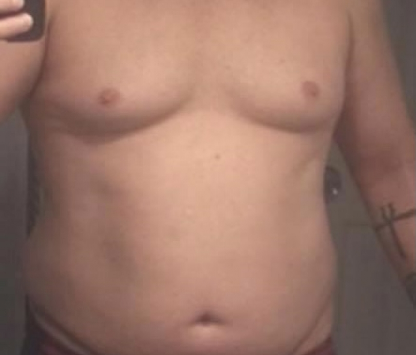 240lbs with heart disease and pre diabetic